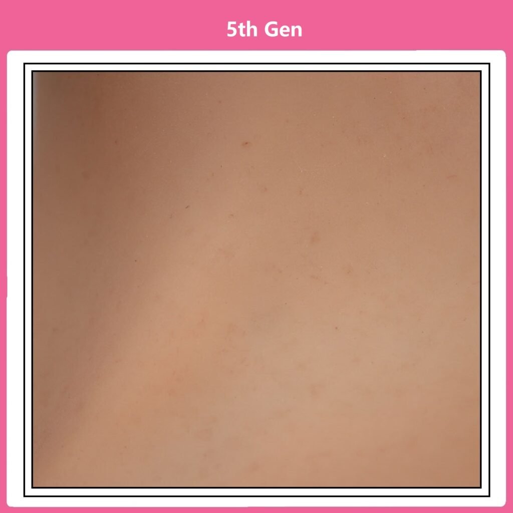 Full Upper Vest High Collar Silicone Breast Forms 4th Gen